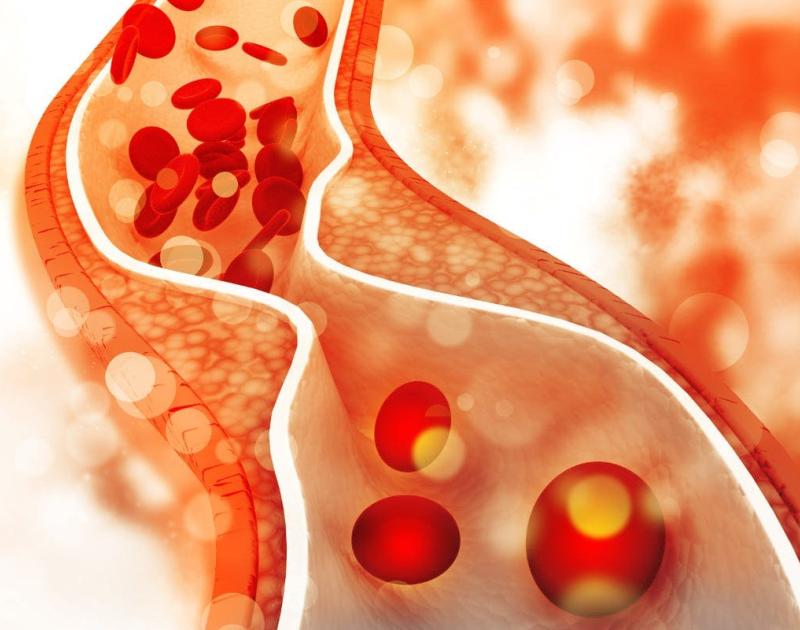 Infosessie Cholesterol © google